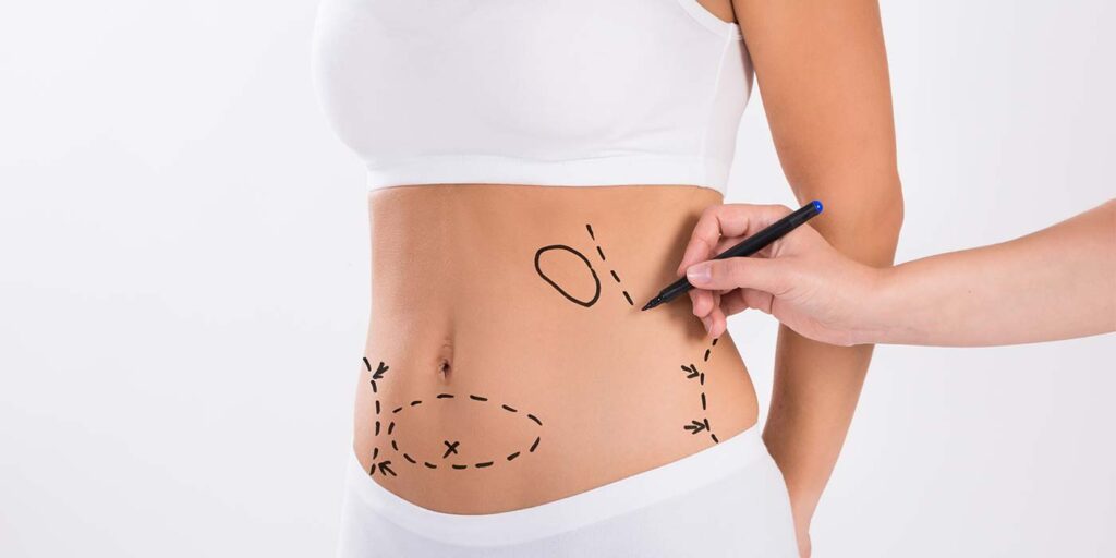 Tummy Tuck Surgery cost in India