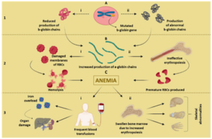 Thalassemia Treatment