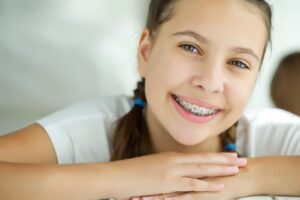 Colored Braces