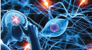 Common Neurological Disorders Treated by Top Neurologists in Delhi
